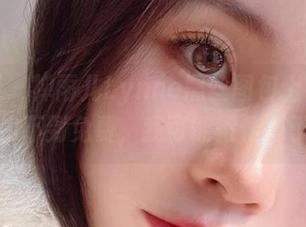 微密圈 – 禅雨儿Lynne黑丝图包上线！如果找不到免费，我可能得伤心了。